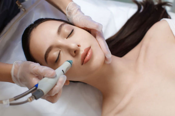 MBEsteticaIntegral_Dermapen